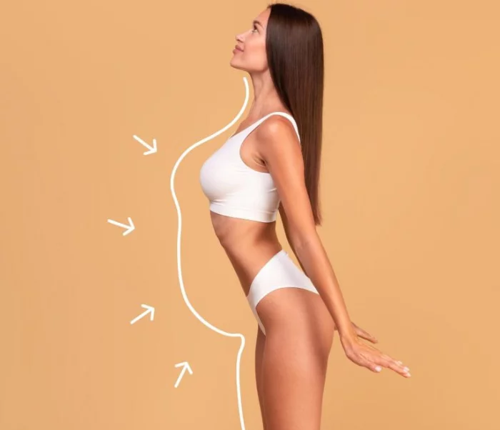 Liposuccion - Lipoescultura